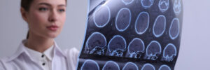 Doctor examining MRI images of patient with multiple sclerosis